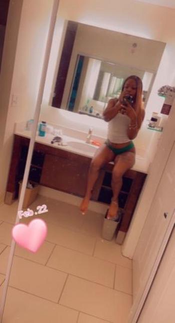 Summer Love, 22  female escort, Worcester